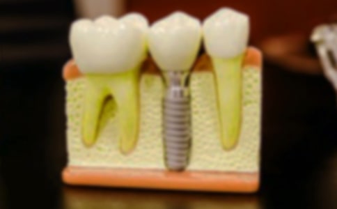 [����]�����ǵ�����