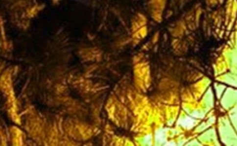 �����ֳ�����Ӧ��Ԥ����ͨ��15ƪ��