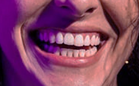 ���������������ڶ�ԭ��Ӧ�Դ�ʩ