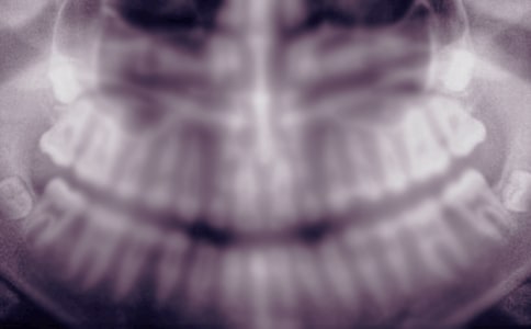 ���ǳݰ�ĸ��������ռ�