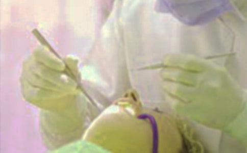 【精华】拔牙的作文300字四篇