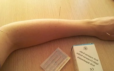 针灸室工作制度(通用10篇)